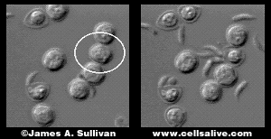 Cryptosporidium parvum